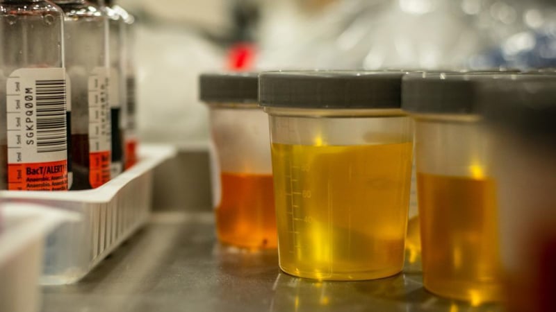 THC drug test urine samples in a lab