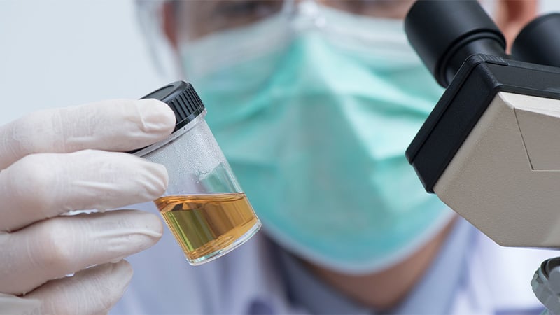 A doctor holding a urine sample for drug test.